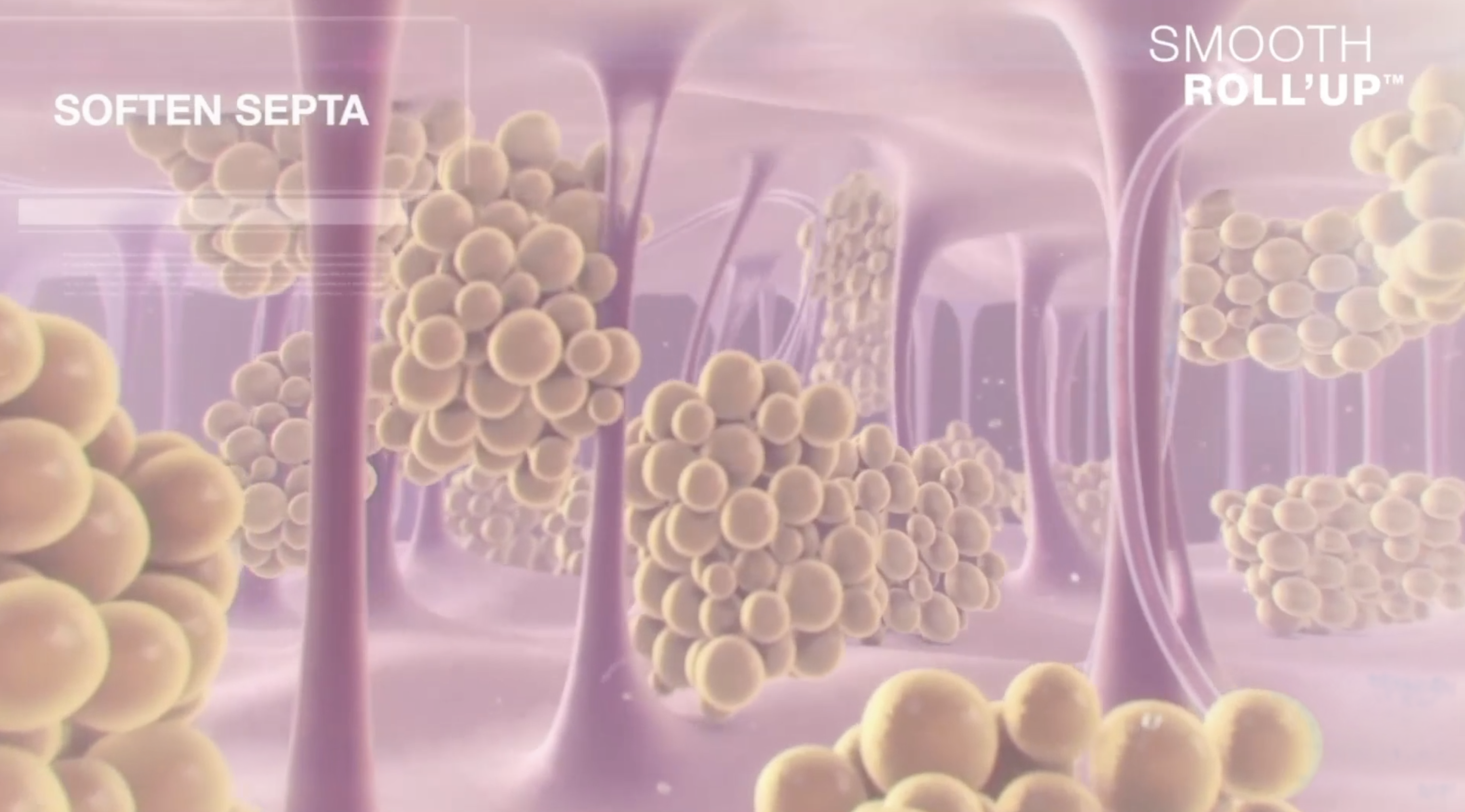 LPG Body Endermologie thumbnail
